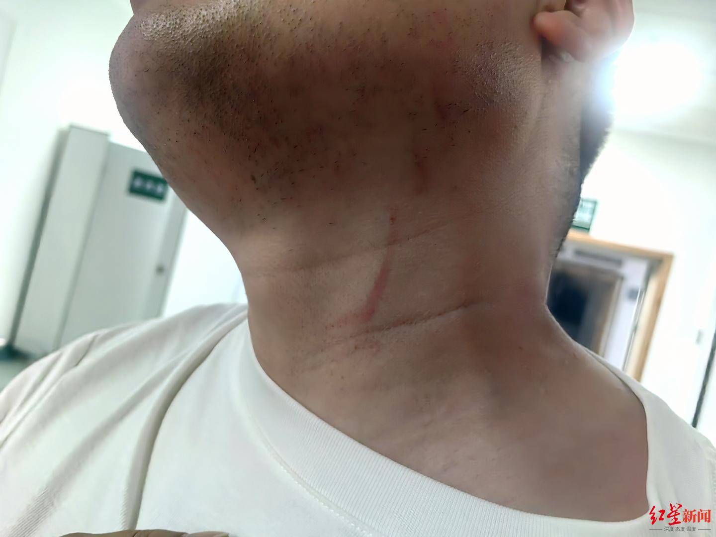 皇冠信用盘结算日是哪天
_武汉男子拍摄违停时被当街殴打皇冠信用盘结算日是哪天
，打人者被罚款500元，被打者称将提起行政复议并起诉